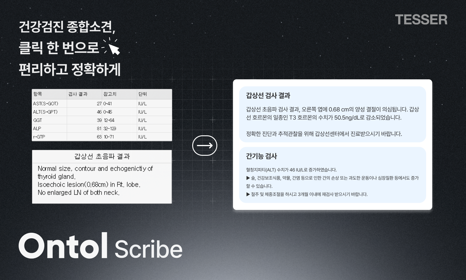 온톨 스크라이브: AI 기반 종합소견 자동생성 솔루션